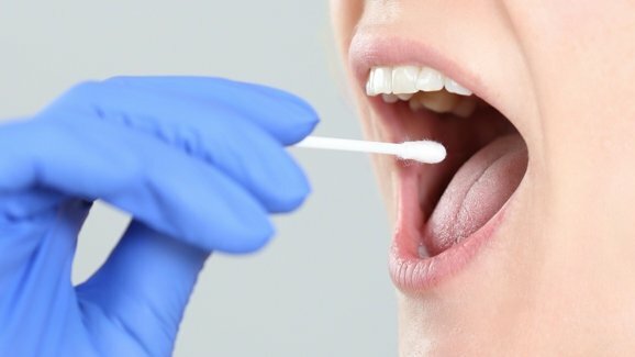Teste de saliva pode ser ferramenta eficaz para diagnosticar doença renal