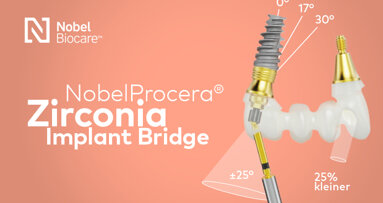 De NobelProcera Zirconia Implant Bridge
