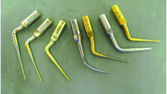 DT News - MEA - Management of Intracanal Separated Instruments