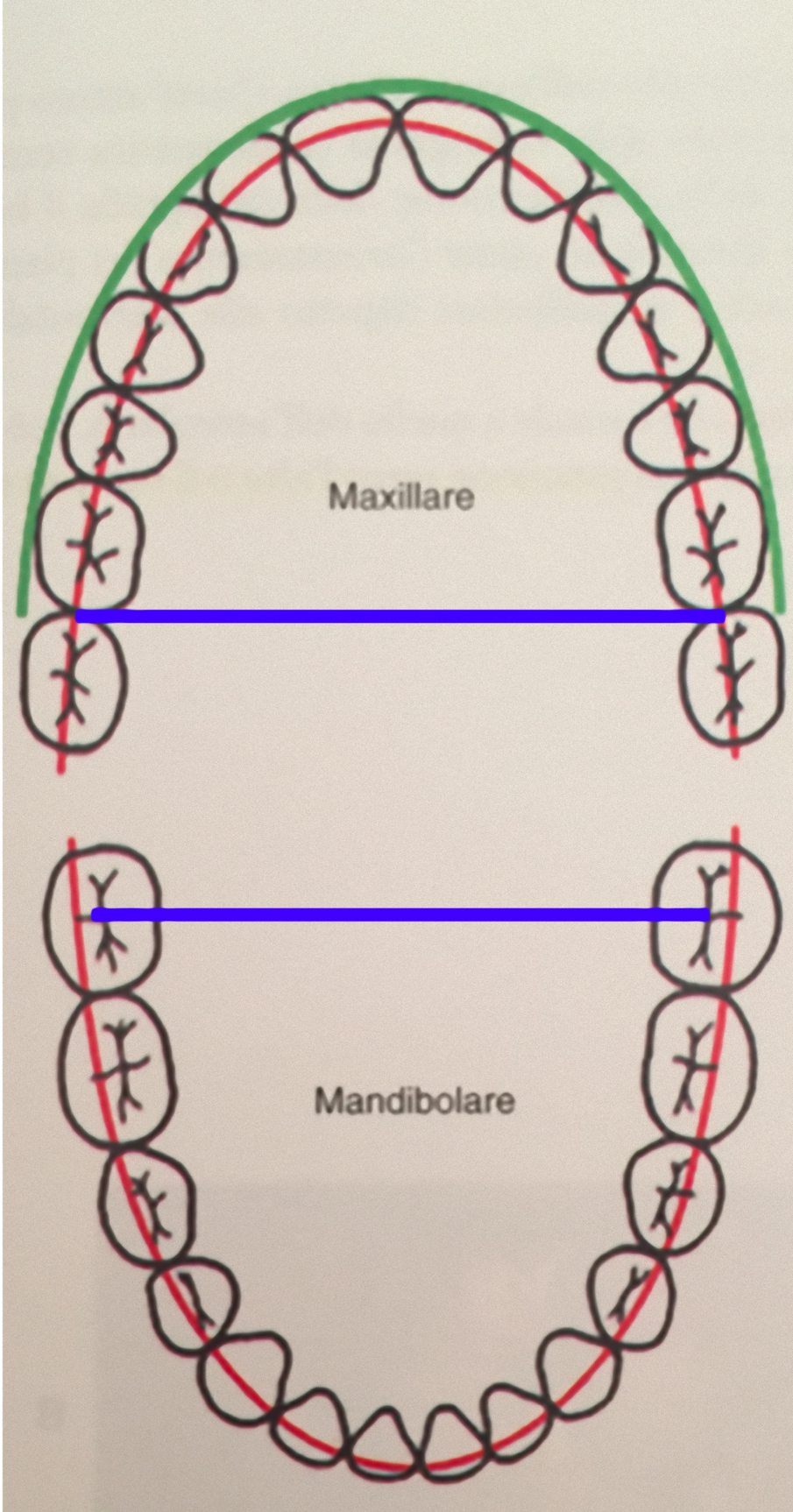 Fig. 10_Ampiezza mascellare e mandibolare a confronto (W R Proffit, H. W. (2008). Ortodonzia moderna. Milano: Edra Masson).