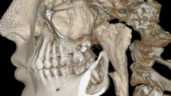 3-day, in-depth CBCT course set
