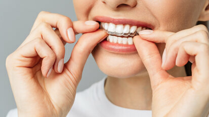 Numerous professional dental bodies reach consensus on DIY orthodontics