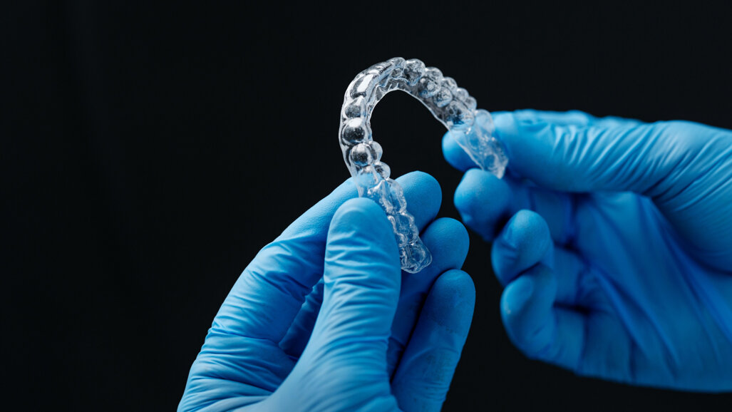 A non-surgical orthodontic approach using clear aligners in a Class III adult patient