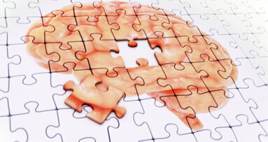 Une étude confirme que la récession gingivale augmente le risque de maladie d'Alzheimer