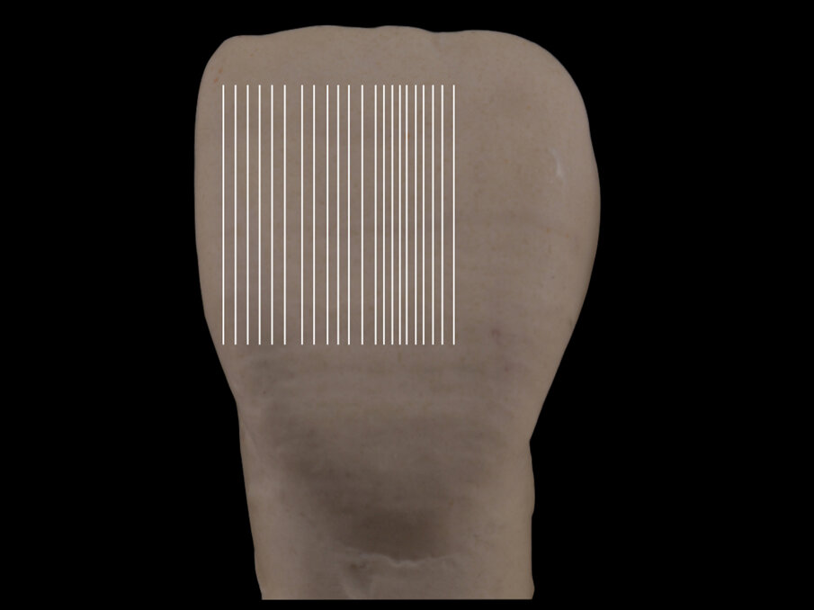 Fig. 6 - Con linee verticali lunghe e ravvicinate, il dente appare più lungo.
