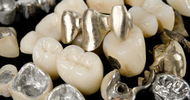 ADA offers advice on how to handle dental scrap