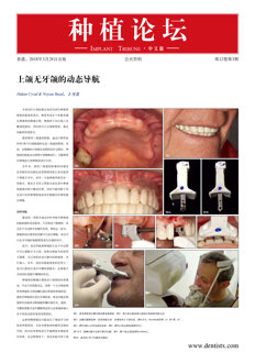 Implant Tribune China No. 1, 2018