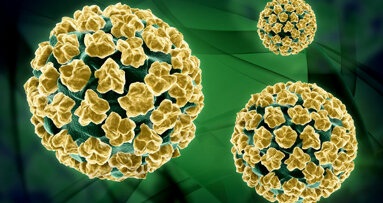 Tumor durch Papillomavirus: Gute Heilungschancen