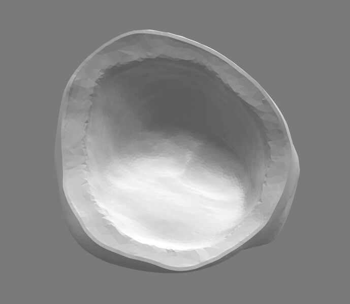Fig. 3: Design for crown for tooth #11, internal view.