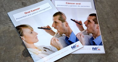 Sunstar supports release of chairside guide on prevention and treatment of oral cancer