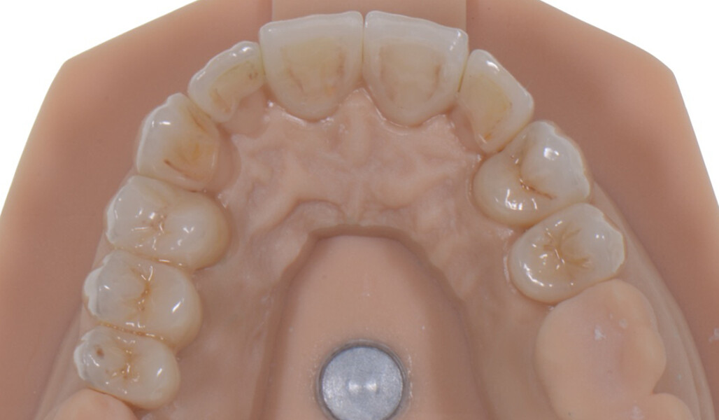 Fig. 19: Occlusal view of the lifelike restorations.