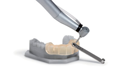 Digitální implantologie se stolní 3D tiskárnou