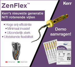 ZenFlex, de nieuwste generatie NiTi roterende vijlen!