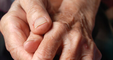 Periodontitis facilitates development and progression of rheumatoid arthritis