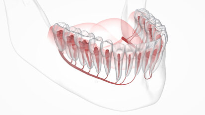 AI may assist in dental implant surgery, localising mandibular canals