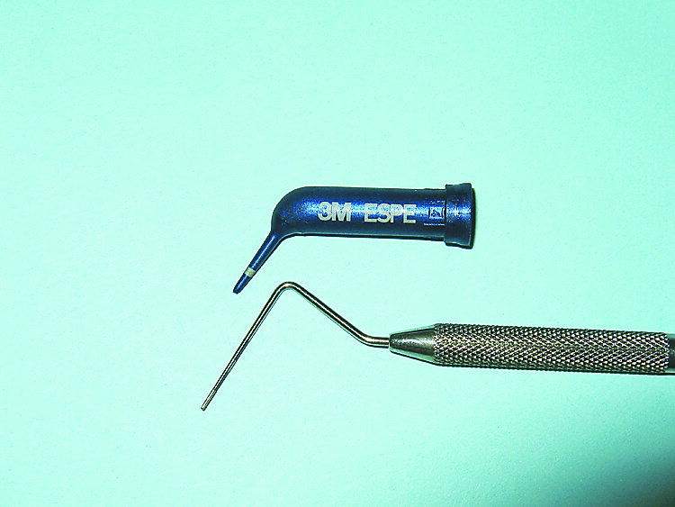 Fig. 3. 3M Retraction Capsule and periodontal probe tips are similar in size.