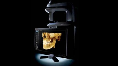 Tomograf CS 9300 –  nowa jako obrazowania   stomatologiczno-laryngologicznego