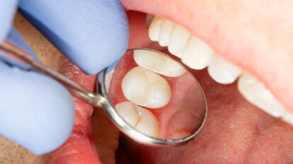 Transforming dentistry: Direct restoration procedures simplified