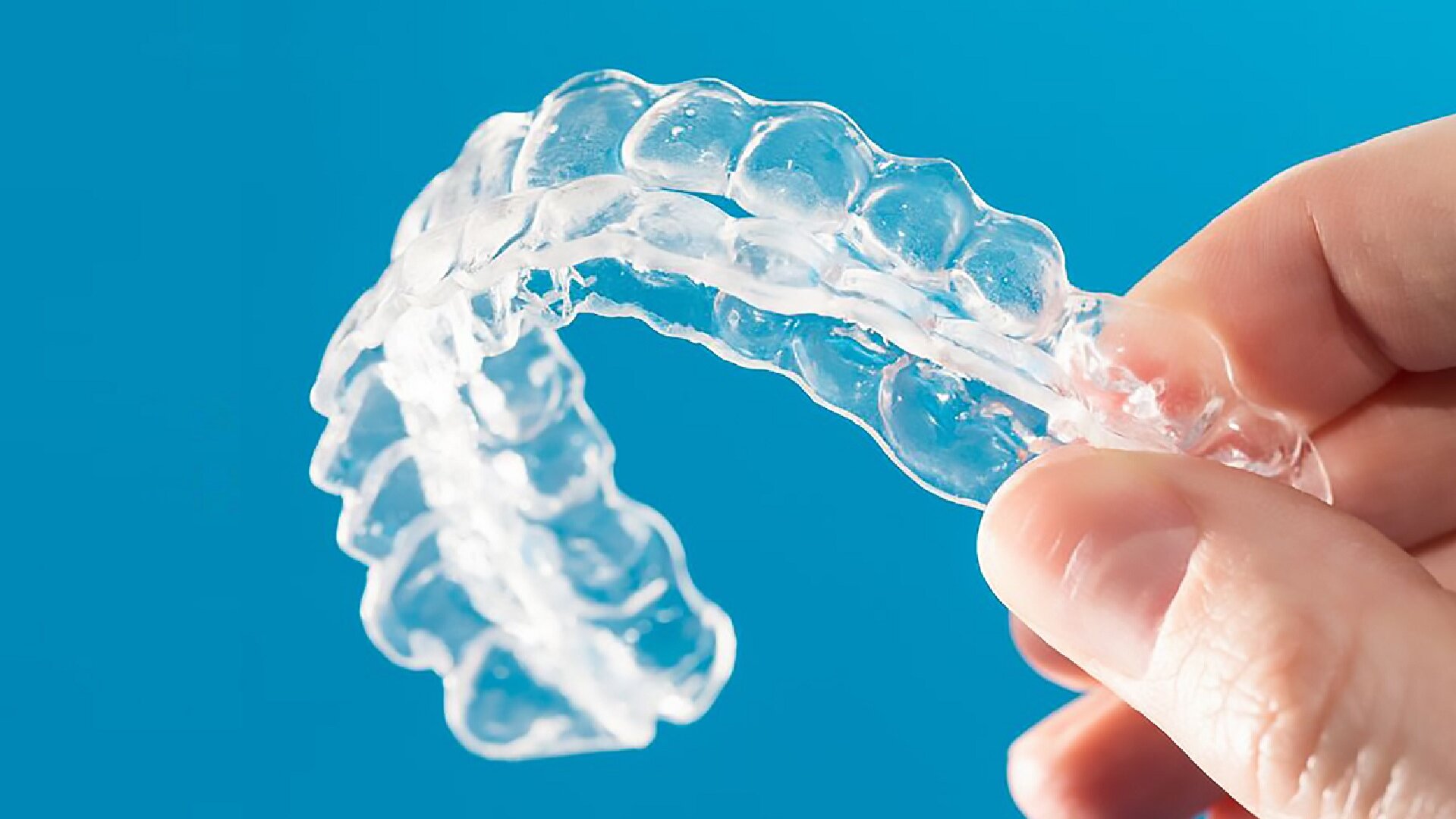 Invisible orthodontics market North American market remains solid, Chinese market grows rapidly
