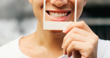 Why dental veneers are not without risk