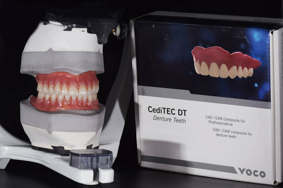 Fig. 22: Individualised, digitally produced complete maxillary and mandibular dentures in their finished state on the 3D-printed master models in the articulator (CediTEC).
