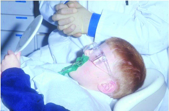 Figure 1: The conventional specialist approach: the child having had local anaesthesia and rubber dam placement in preparation for the restoration of 55 which had deep caries into the pulp