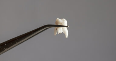 Des algorithmes d'apprentissage automatique pour identifier les risques de perte de dents