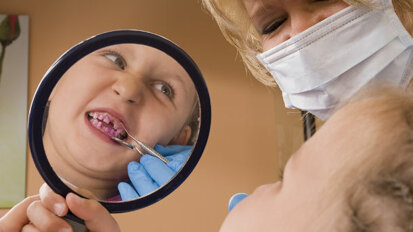 Popravke zuba bez bušenja jednako su uspešne kao amalgamske plombe