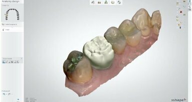 3Shape lança o Dental System 2014