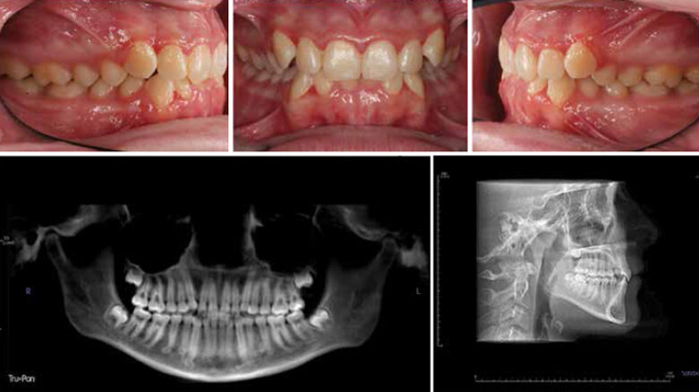 Orthodontic treatment changes and efficiencies during COVID-19 pandemic