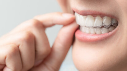 Pandemic-proof? Align Technology sold a record number of clear aligners in 2020