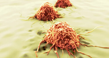 Le nombre de cellules souches cancéreuses pourrait de ne pas aider à prévoir la progression d’une tumeur et sa récurrence