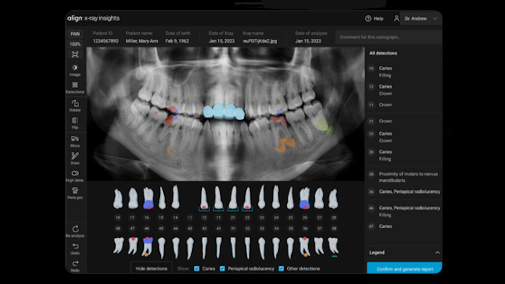 Align Technology unveils new version of its ClinCheck treatment planning  software - Channel Post MEA