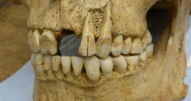 Výzkum využívá zubní plak k odkrytí složení starověké stravy