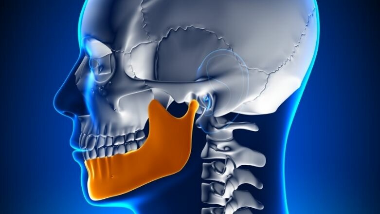 Correlating rotated mandibles with back & knee pain
