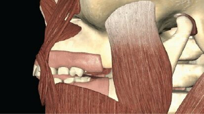 Onemocnění čelistního kloubu a ortodoncie