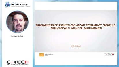 Trattamento dei pazienti con arcate totalmente edentule: applicazioni cliniche dei mini impianti