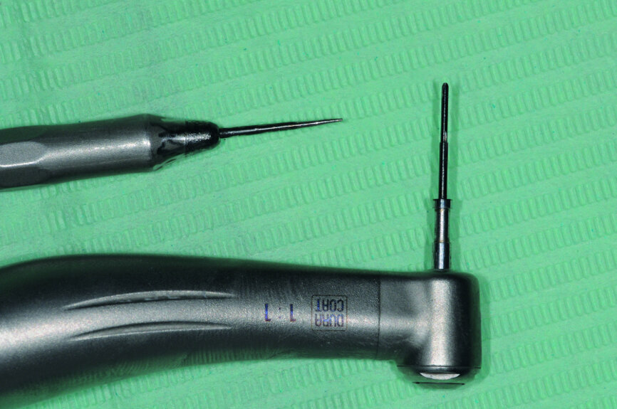Figure 2 : Ostéotenseurs manuel et rotatif, il est à noter que nous
n’utilisons l’osteotenseur rotatif qu’à la mandibule, lorsque nous désirons « assouplir » l’os pour une chirurgie de greffe par exemple.