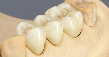 CAD/CAM, la tecnología que está revolucionando la industria dental (1)