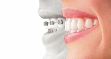 El desplazamiento dental ¿Ciencia de la salud o cosmética peligrosa?