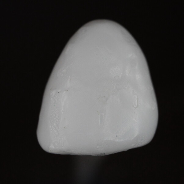Fig. 12: 3D-printed veneer for tooth #22, facial view.
