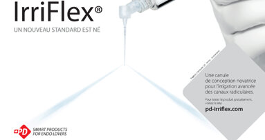IrriFlex, une canule de conception innovante pour l'irrigation canalaire avancée