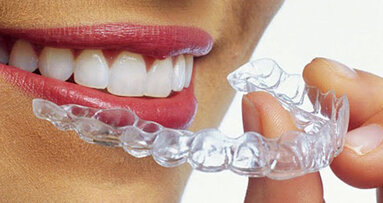 Spotlight on Invisalign: Pros and cons of treatment planning with clear aligners