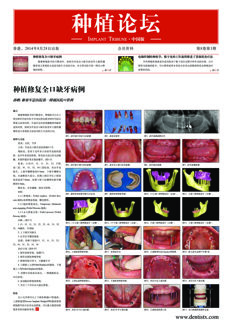 Implant Tribune China No. 3, 2014