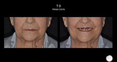 Sinergie tra odontoiatria e biorivolumetria: l’approccio terapeutico per tornare a sorriderSi