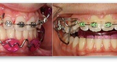 ¿Debe la industria dental determinar el futuro de la Ortodoncia?