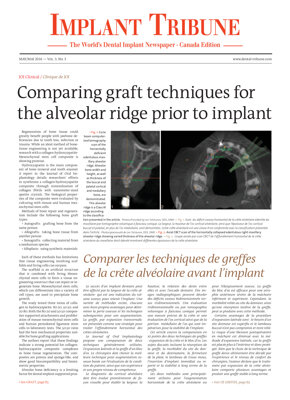 Implant Tribune Canada No. 3, 2016