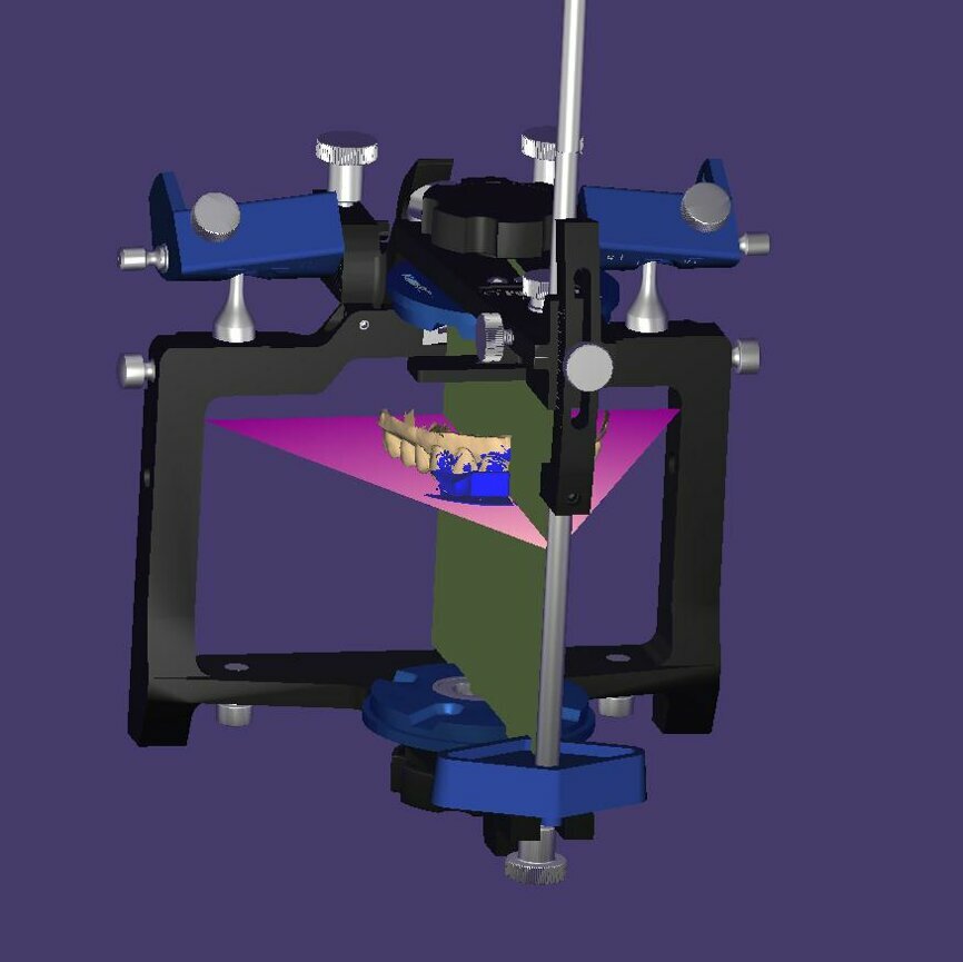 Fig. 10: Lateral view of the model orientation based on the
vertical plane of the virtual articulator.