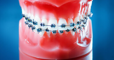 Orthodontisten worden goedkoper