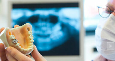 Dental association raises awareness as implant industry grows